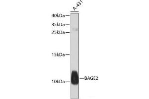 Western blot analysis of extracts of A-431 cells using BAGE2 Polyclonal Antibody at dilution of 1:1000. (BAGE2 抗体)