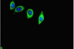 Immunofluorescent analysis of HepG2 cells using ABIN7144126 at dilution of 1:100 and Alexa Fluor 488-congugated AffiniPure Goat Anti-Rabbit IgG(H+L) (ACE2 抗体  (AA 395-638))