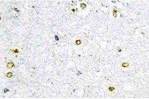 Immunohistochemistry (IHC) analyzes of TIF1alpha antibody in paraffin-embedded human brain tissue. (TRIM24 抗体)