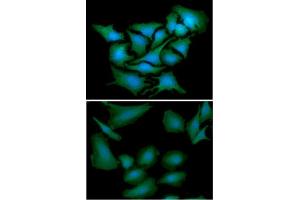 ICC/IF analysis of DNAL1 in HeLa cells line, stained with DAPI (Blue) for nucleus staining and monoclonal anti-human DNAL1 antibody (1:100) with goat anti-mouse IgG-Alexa fluor 488 conjugate (Green). (DNAL1 抗体  (AA 1-190))