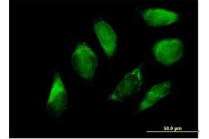 Immunofluorescence of purified MaxPab antibody to SERPINH1 on HeLa cell. (SERPINH1 抗体  (AA 1-418))