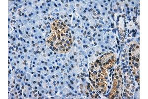 Immunohistochemical staining of paraffin-embedded Kidney tissue using anti-HDAC10mouse monoclonal antibody. (HDAC10 抗体)