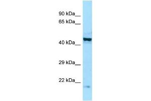 WB Suggested Anti-EIF2B2 Antibody Titration: 1. (EIF2B2 抗体  (Middle Region))