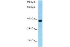 Image no. 1 for anti-Cysteine-Rich with EGF-Like Domains 2 (CRELD2) (AA 135-184) antibody (ABIN6748231) (CRELD2 抗体  (AA 135-184))