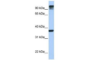 EPS15 antibody used at 1 ug/ml to detect target protein. (EPS15 抗体  (C-Term))
