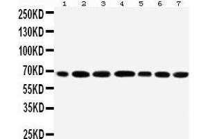 Anti-DDX5 antibody, Western blotting All lanes: Anti DDX5  at 0. (DDX5 抗体  (C-Term))