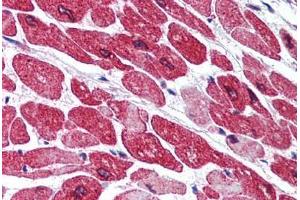 Human Heart (formalin-fixed, paraffin-embedded) stained with AOF2 antibody ABIN290327 at 5 ug/ml followed by biotinylated goat anti-rabbit IgG secondary antibody ABIN481713, alkaline phosphatase-streptavidin and chromogen. (LSD1 抗体  (AA 100-150))