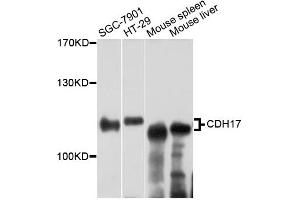 Western blot analysis of extracts of various cell lines, using CDH17 antibody (ABIN5975035) at 1:3000 dilution. (LI Cadherin 抗体)