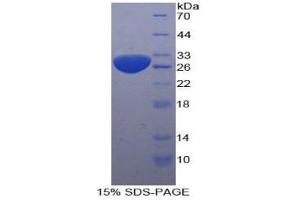 SDS-PAGE analysis of Human Sequestosome 1 Protein. (SQSTM1 蛋白)