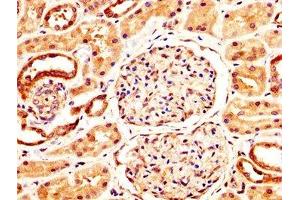 IHC image of ABIN7161797 diluted at 1:400 and staining in paraffin-embedded human kidney tissue performed on a Leica BondTM system. (NFATC3 抗体  (AA 887-1070))
