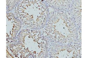 IHC analysis of DDX4/MVH using anti-DDX4/MVH antibody (ABIN7601204). (DDX4 抗体  (AA 3-666))