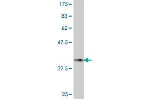 Western Blot detection against Immunogen (37. (Occludin 抗体  (AA 423-522))