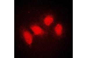 Immunofluorescent analysis of SMG7 staining in A431 cells. (SMG7 抗体  (Center))
