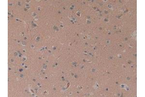 IHC-P analysis of Human Brain Tissue, with DAB staining. (CYLD 抗体  (AA 170-338))