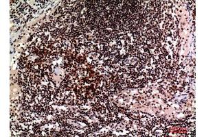 Immunohistochemistry (IHC) analysis of paraffin-embedded Human Lymph, antibody was diluted at 1:100. (2B4 抗体  (Internal Region))