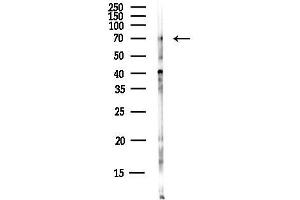Western blot analysis of lysates from EC304 cells(heat-shock,45 min treatment), using PRKG1 Antibody at 1/1000 dilution.