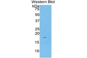 WB of Protein Standard: different control antibodies against Highly purified E. (Haptoglobin CLIA Kit)