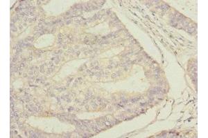 Immunohistochemistry (IHC) image for anti-Signal Transducing Adaptor Molecule (SH3 Domain and ITAM Motif) 2 (STAM2) (AA 376-525) antibody (ABIN7169694)