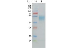 Cynomolgus CD24 Protein, hFc Tag on SDS-PAGE under reducing condition.