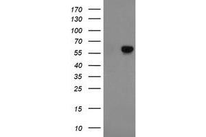 Western Blotting (WB) image for anti-Formiminotransferase Cyclodeaminase (FTCD) antibody (ABIN1496378) (FTCD 抗体)