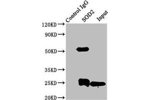 Immunoprecipitating SOD2 in K562 whole cell lysate Lane 1: Rabbit control IgG instead of ABIN7170983 in K562 whole cell lysate. (SOD2 抗体  (AA 64-175))