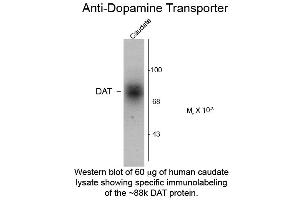 Western blot of Dopamine Transporter C-Terminus Human Antibody Western Blot of Rabbit Anti-Dopamine Transporter C-Terminus Human Antibody. (SLC6A3 抗体  (C-Term))