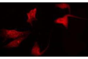 ABIN6272322 staining K562 by IF/ICC. (HOXD10 抗体  (Internal Region))