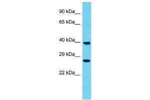 Host: Rabbit Target Name: FBXO44 Sample Type: Fetal Heart lysates Antibody Dilution: 1. (FBXO44 抗体  (Middle Region))