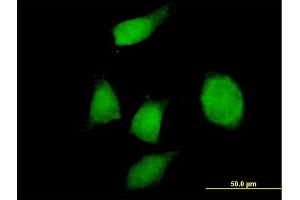 Immunofluorescence of purified MaxPab antibody to PHF17 on HeLa cell. (PHF17 抗体  (AA 1-509))