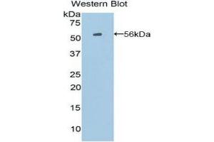 Western Blotting (WB) image for anti-Proopiomelanocortin (POMC) (AA 27-235) antibody (ABIN1860275) (POMC 抗体  (AA 27-235))