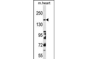 DCC Antibody (Center) (ABIN656268 and ABIN2845581) western blot analysis in mouse heart tissue lysates (35 μg/lane). (DCC 抗体  (AA 643-670))