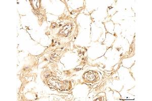 IHC analysis of EIF4B using anti-EIF4B antibody (ABIN7599496).