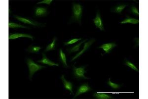 Immunofluorescence of monoclonal antibody to CRY2 on HeLa cell. (CRY2 抗体  (AA 141-231))
