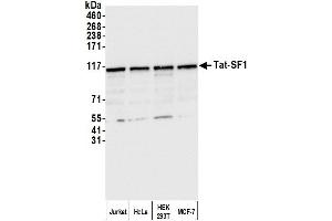 anti-HIV-1 Tat Specific Factor 1 (HTATSF1) (AA 375-425) antibody
