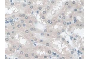 IHC-P analysis of Rat Kidney Tissue, with DAB staining. (TPSB2 抗体  (AA 30-274))