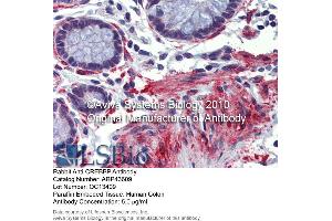 Immunohistochemistry (IHC) image for anti-CREB Binding Protein (CREBBP) (N-Term) antibody (ABIN2781491) (CBP 抗体  (N-Term))