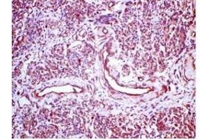 Immunohistochemistry (IHC) image for anti-Progesterone Receptor (PGR) (AA 922-933), (C-Term) antibody (ABIN781660)