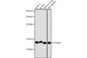 Western blot analysis of extracts of various cell lines, using S100 antibody (842) at 1:1000 dilution. (S100A9 抗体  (AA 1-114))