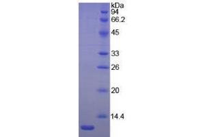 SDS-PAGE analysis of Mouse Laminin beta 2 Protein. (LAMB2 蛋白)