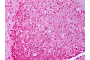 Anti-HSP90 antibody IHC of human tonsil, germinal center. (HSP90 alpha/beta 抗体)