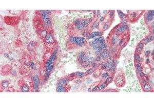 Immunohistochemistry of paraffin-embedded Placenta tissue using CD151 Polyclonal Antibody at dilution of 1:120.