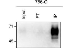 786-O cell lysate was prepared by 1 mL of RIPA buffer from 1. (BST2 抗体)