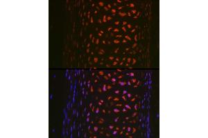 Immunofluorescence analysis of rat trachea using MMP13 Rabbit pAb (ABIN7268418) at dilution of 1:100 (40x lens).