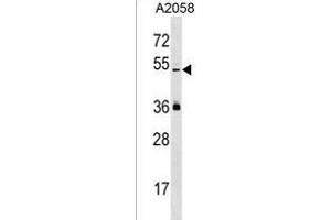 PREL Antibody (Center) (ABIN1537984 and ABIN2850411) western blot analysis in  cell line lysates (35 μg/lane). (PRAMEL 抗体  (AA 184-211))