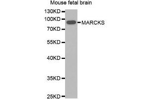 Western blot analysis of extracts of Mouse fetal brain, using MARCKS antibody. (MARCKS 抗体)
