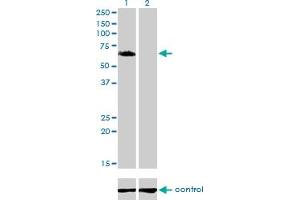 Western blot analysis of GGA1 over-expressed 293 cell line, cotransfected with GGA1 Validated Chimera RNAi (Lane 2) or non-transfected control (Lane 1). (GGA1 抗体  (AA 1-89))