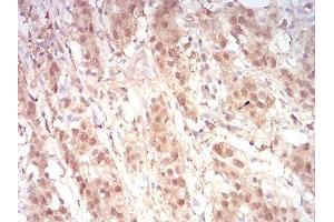 Immunohistochemistry (IHC) image for anti-RAN, Member RAS Oncogene Family (RAN) (AA 1-216) antibody (ABIN5876159) (RAN 抗体  (AA 1-216))