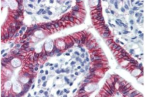 Human Small Intestine: Formalin-Fixed, Paraffin-Embedded (FFPE) (LI Cadherin 抗体  (AA 24-132))