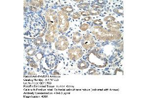 Rabbit Anti-RAVER1Antibody  Paraffin Embedded Tissue: Human Kidney Cellular Data: Epithelial cells of renal tubule Antibody Concentration: 4. (RAVER1 抗体  (N-Term))