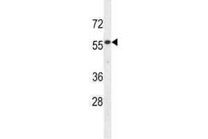 IL17RE antibody western blot analysis in HepG2 lysate. (IL17RE 抗体  (AA 87-116))